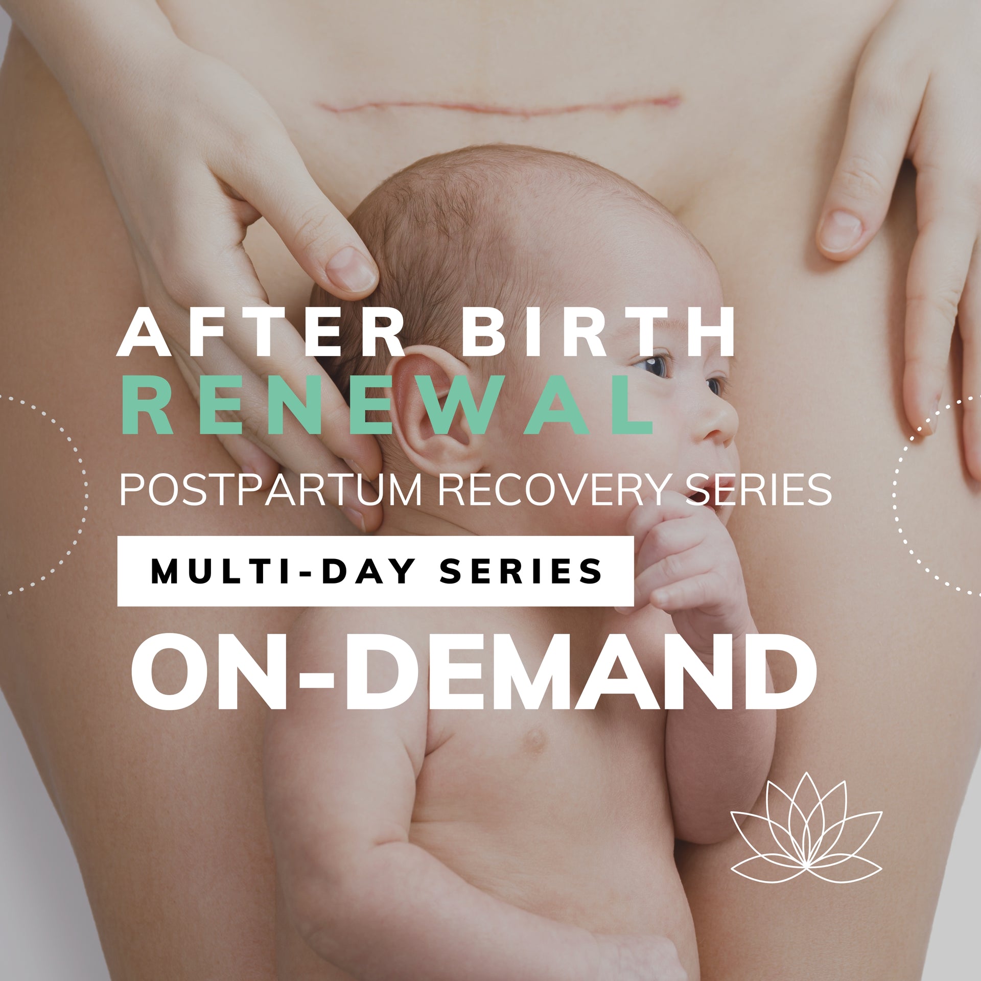 After Birth Renewal: Postpartum Recovery Series